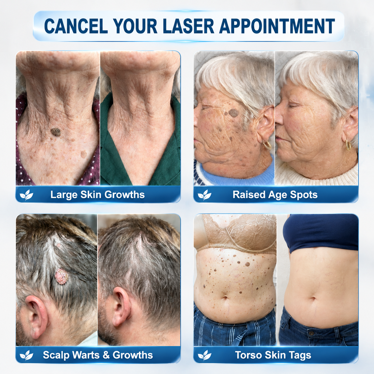 FDA Registered Facility | LUMIVO™ 7-Day Skin Tag & Spot Eraser Painless & Scar-Free Advanced Imperfection Removal Rollerball Pen